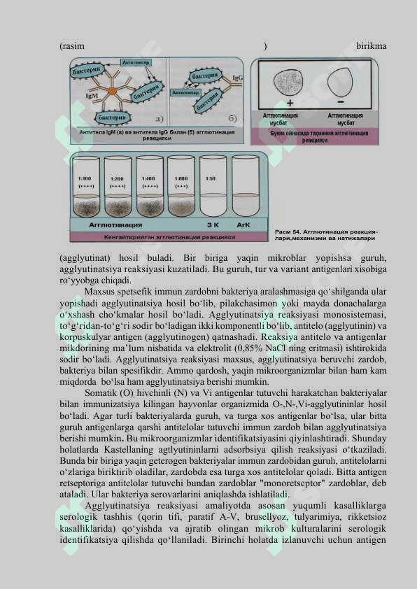 Antigen va antitelalar. Immunologik reaksiyalar, ularning tarkibiy qismlari (antigyenlar, antitelalar), qo‘yishdan maqsad. Diagnostikum va diagnostik zardoblar xaqida tushuncha. Diagnostik zardoblarni olish usullari 6