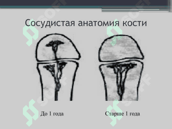 Острый гематогенный остеомиелит у детей 4