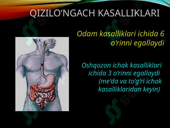 Qizilo’ngach kuyishi va yot jism 2