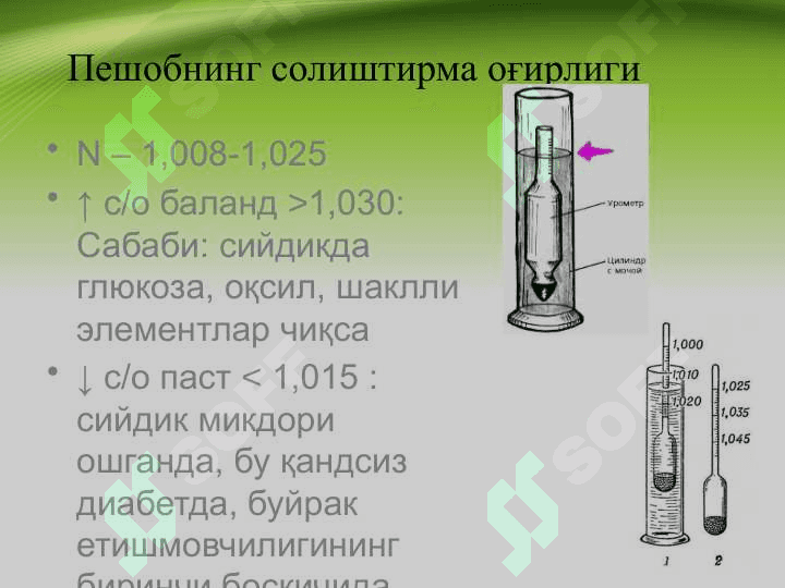 Siydik tekshiruvi . Peshob tahlili . Пешоб таҳлили . Сишдик текшируви 7