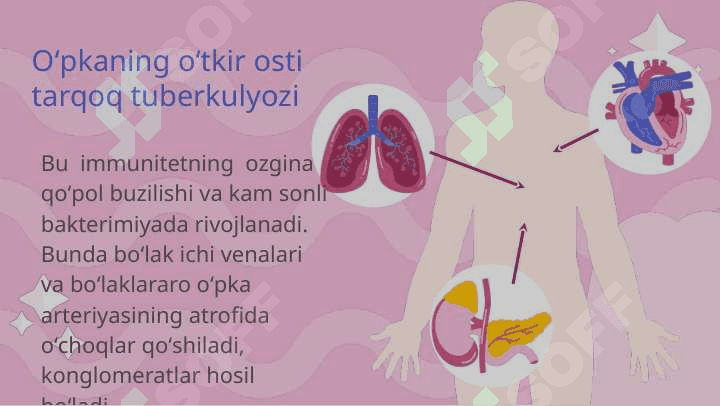 O'pkaning tarqoq tuberkulyozi. Millar tuberkulyozi. 5