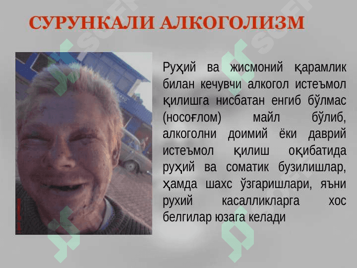Психофаол моддаларга  қарамлик билан боғлиқ касалликлар 8