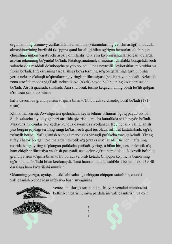 TERI VA TERI OSTIYOG' QATLAMINING YALLIG'LANISH KASALLIKLARI 2