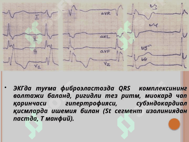 БОЛАЛАРДА НОРЕВМАТИК КАРДИТ 6