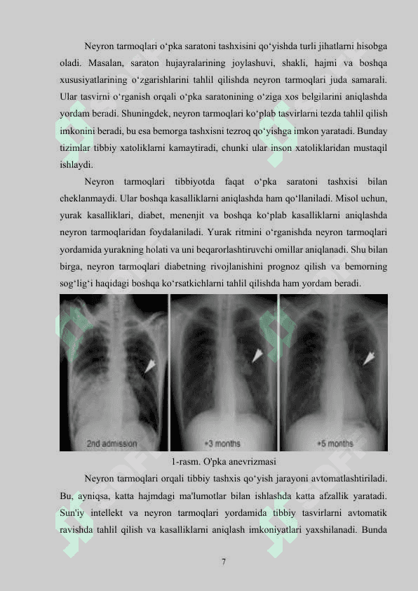 Neyron tarmoqlar asosida o‘pka saratoni kasalligini aniqlash dasturini ishlab chiqish 7