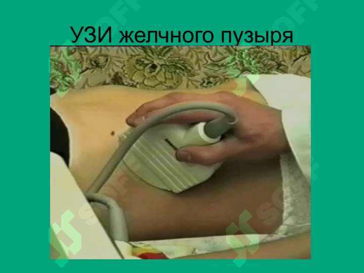 АБОЛЕВАНИЯ ЖЕЛЧНОГО ПУЗЫРЯ И ЖЕЛЧЕВЫВОДЯЩИХ ПУТЕЙ 6