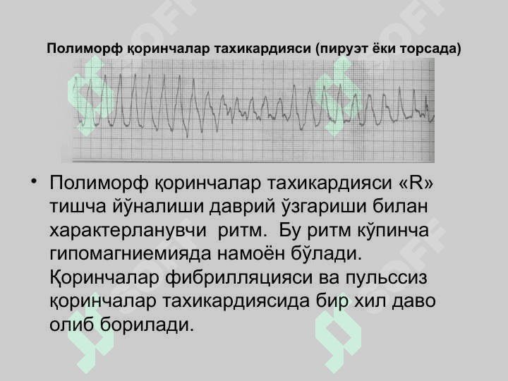 Кардиологик шошилинч ёрдам. Аритмиялар, таърифи, клиник белгилари. Юрак етишмовчилиги. Кардиоген шок, Юрак тўхташи ва тўсатдан ўлим. Юракнинг электромеханик диссоциацияси. Периферик қон томир шошилинч ҳолатлари 4