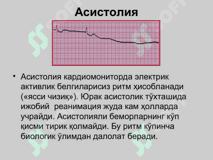 Кардиологик шошилинч ёрдам. Аритмиялар, таърифи, клиник белгилари. Юрак етишмовчилиги. Кардиоген шок, Юрак тўхташи ва тўсатдан ўлим. Юракнинг электромеханик диссоциацияси. Периферик қон томир шошилинч ҳолатлари 7