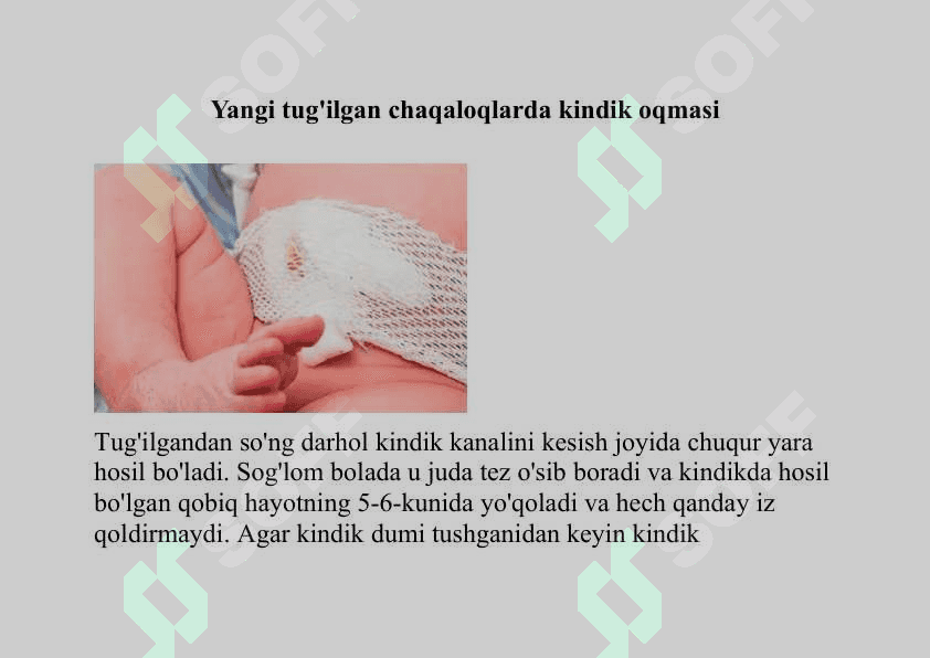 Yangi tug'ilgan chaqaloqlarda kindik oqmasi. Oqma 2