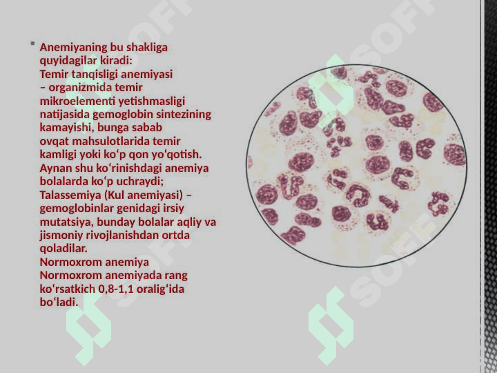 Aplastik Anemiya: Alomatlar. Aplastik Anemiya Diagnostikasi Va Davolash 5