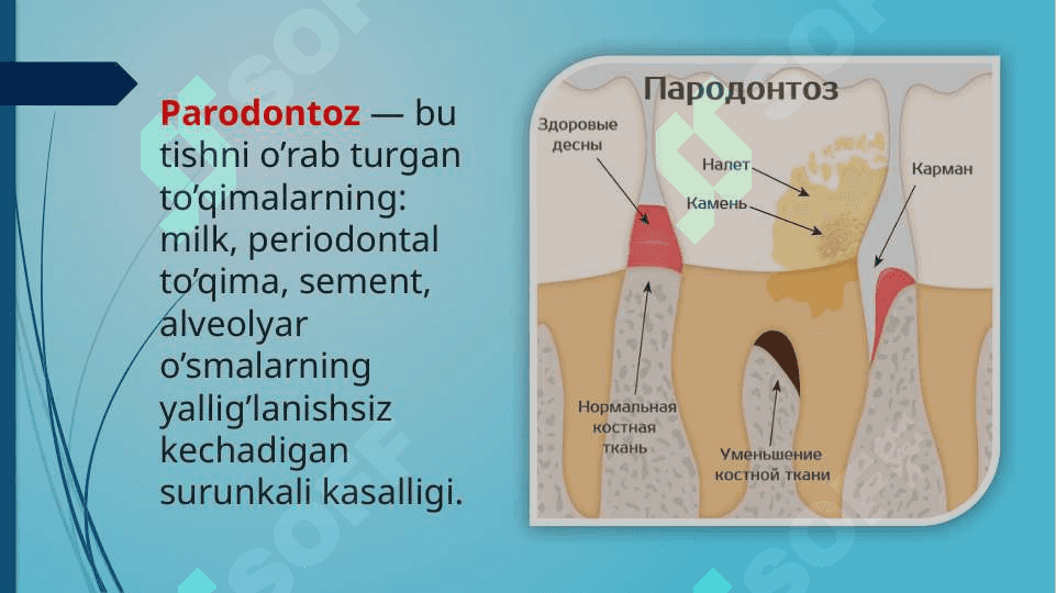 Bolalarda parodontoz 3
