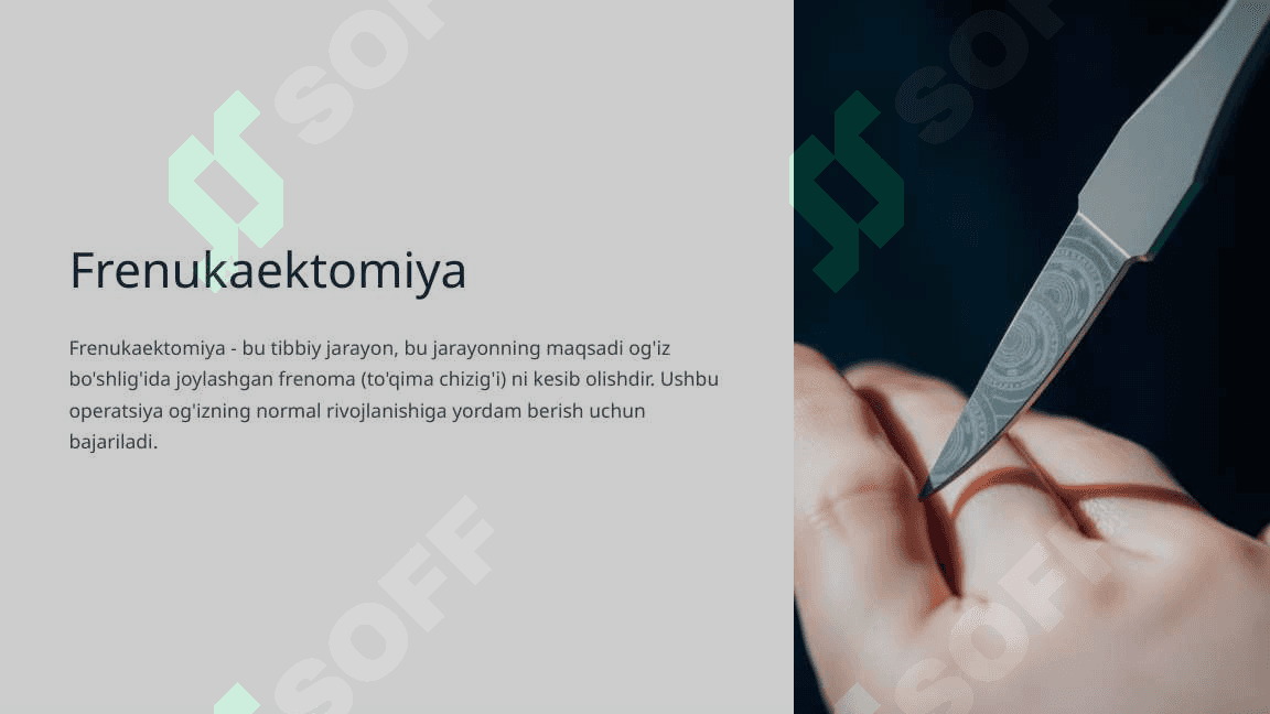 Frenulaektomiya 3