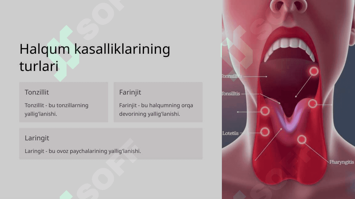 Halqum kasalliklari 3
