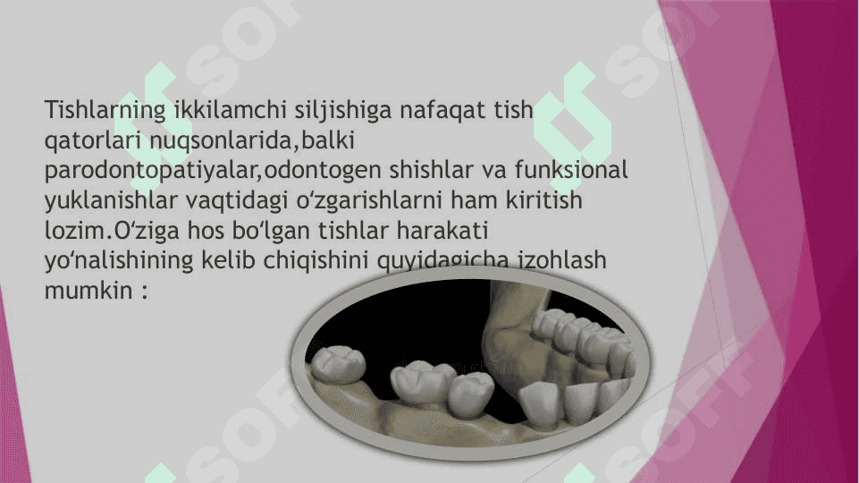 Tish qatori deformatsiyalarini            Gavrilov va Ponomaryova boʻyicha tasniflari 4