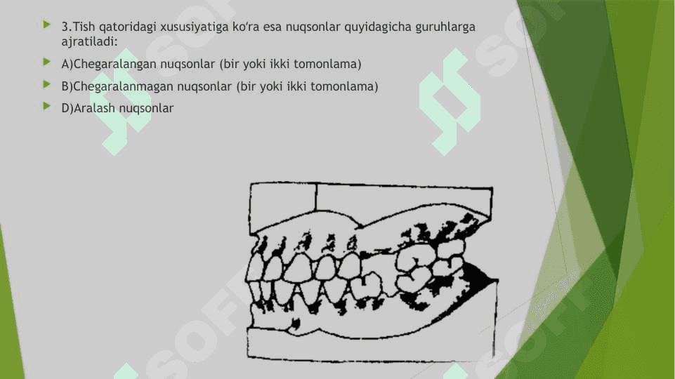 Tish qatorlari qisman nuqsonlarining Grozovskiy,Amiraev va Perzashkevich boʻyicha tasniflari 8