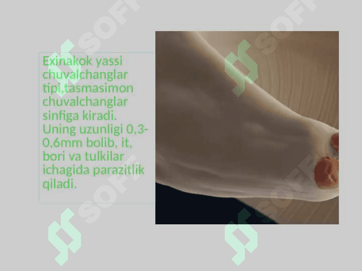 Parazit chuvalchanglarning xilma - xilligi 3