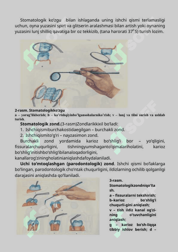 Stomatologik asboblarni tasnifi. Ko’rish va plombani qorish va qo’yishda ishlatiladigan asboblar 2