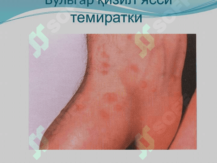 Qizil yassi temiratki . Қизил ясси темиратки 8