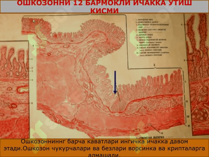ХАЗМ СИСТЕМАСИ ИНГИЧКА ИЧАК,ЙУГОН ИЧАК 3