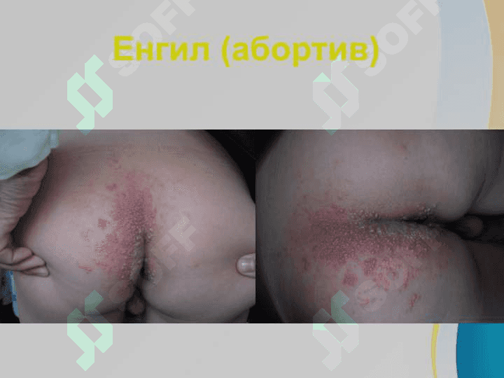 O'rab oluvchi temiratki . Ўраб олувчи темиратки 8