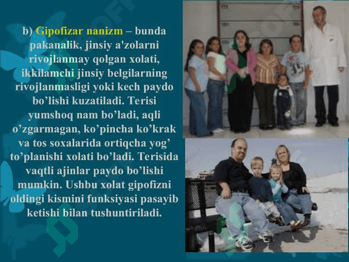 Bolalar o'sish va rivojlanishi buzilishlari semiotikasi 8