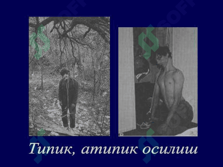 Механик асфиксия 8