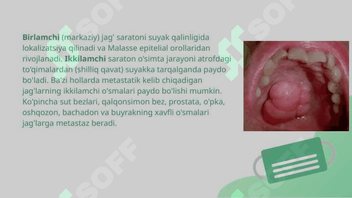 Yuqori jag'ning epitelial va noepitelial xavfli o'smalari 3