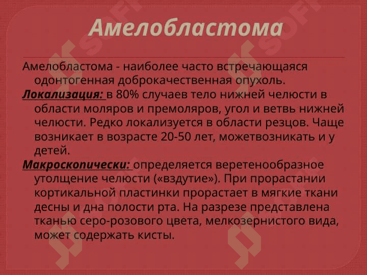 Опухоли челюстно-лицевой области 5