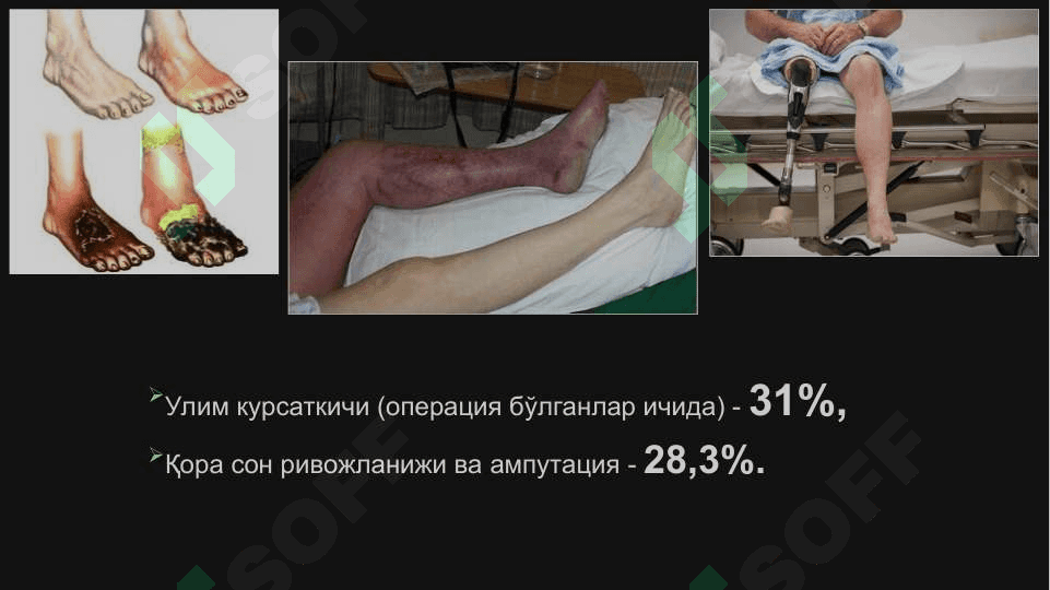 Уткир артериал тутилиш 6