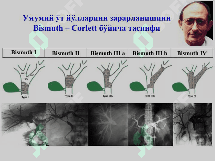 Механик сариқлик, постхолецистэктомик синдром 4