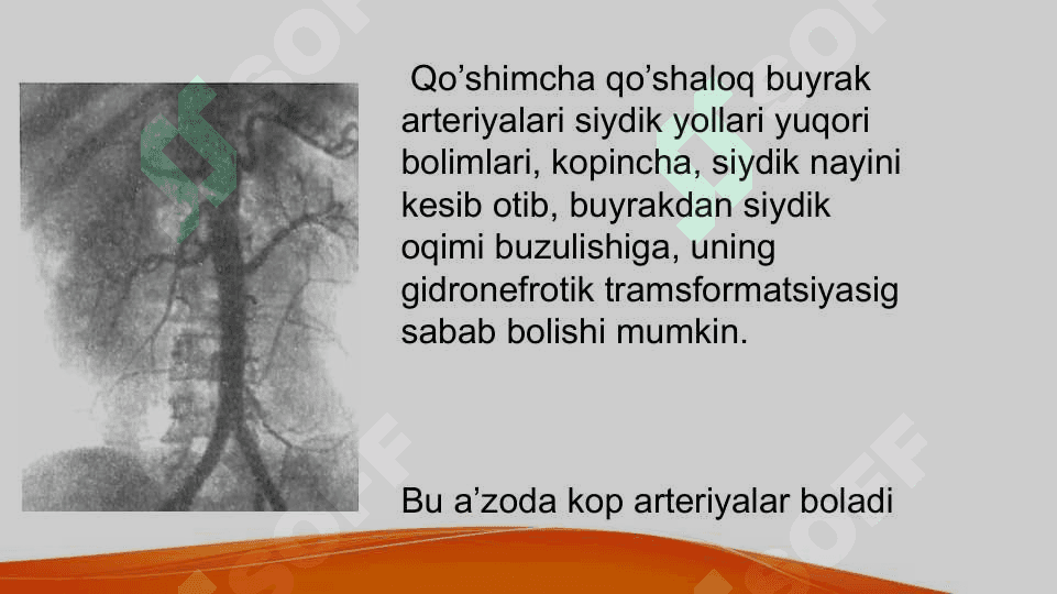 Buyrakning qon tomirlari, arterial tarmoqlari anomaliyalari Buyraklar sonining anomaliyalari Buyraklar joylashish o’rni va shaklining anomaliyalari Buyraklar tuzulishining anomaliyalari Buyraklar anomaliyalarining qo’shilib uchrashi 4