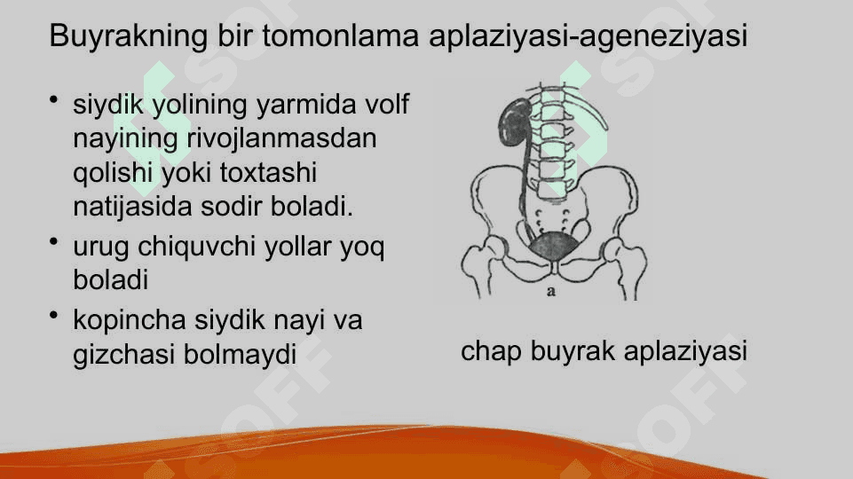 Buyrakning qon tomirlari, arterial tarmoqlari anomaliyalari Buyraklar sonining anomaliyalari Buyraklar joylashish o’rni va shaklining anomaliyalari Buyraklar tuzulishining anomaliyalari Buyraklar anomaliyalarining qo’shilib uchrashi 7