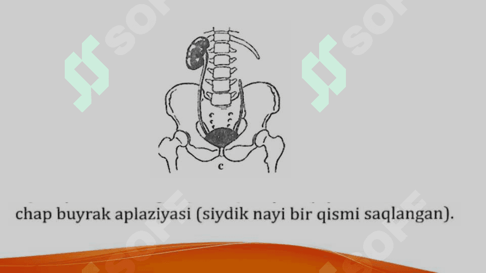 Buyrakning qon tomirlari, arterial tarmoqlari anomaliyalari Buyraklar sonining anomaliyalari Buyraklar joylashish o’rni va shaklining anomaliyalari Buyraklar tuzulishining anomaliyalari Buyraklar anomaliyalarining qo’shilib uchrashi 8
