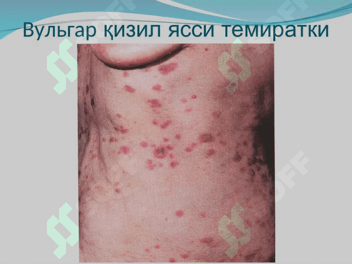Қизил ясси темиратки 7