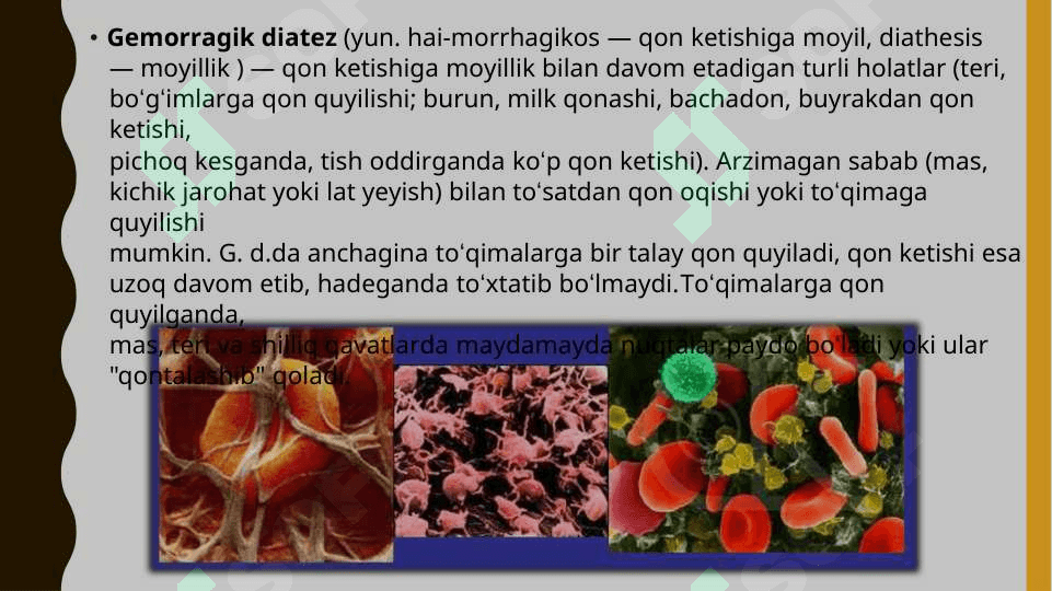 Gemoragik diatez (DVS) sindiromi 2
