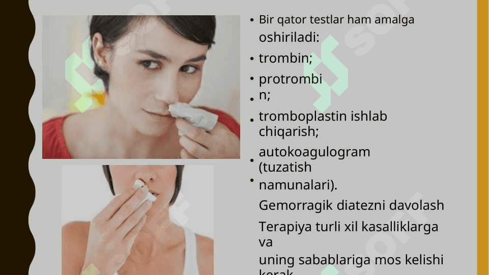 Gemoragik diatez (DVS) sindiromi 8