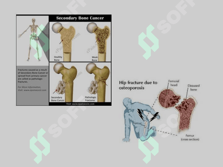Fracture Management and Primary Care 4