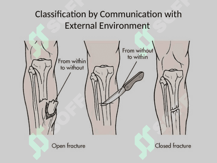 Fracture Management and Primary Care 5