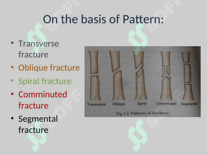 Fracture Management and Primary Care 7