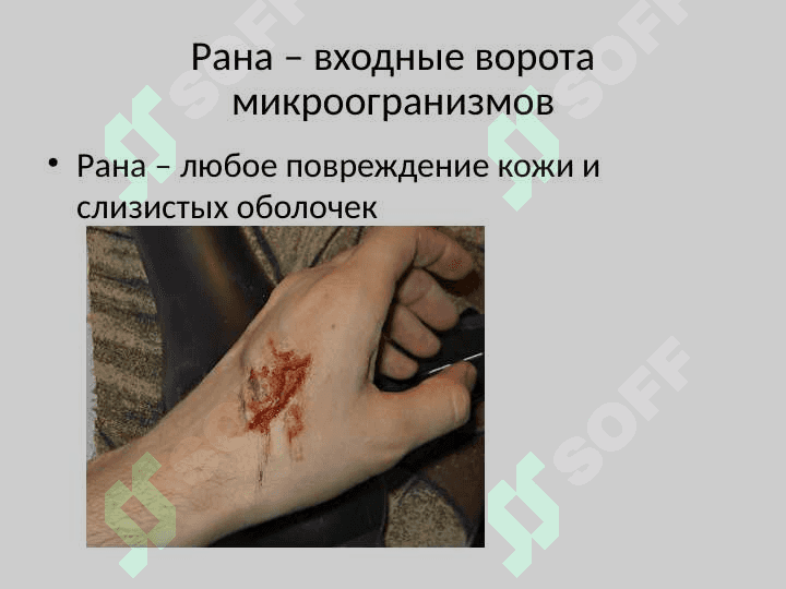 Профилактика хирургической инфекции 4