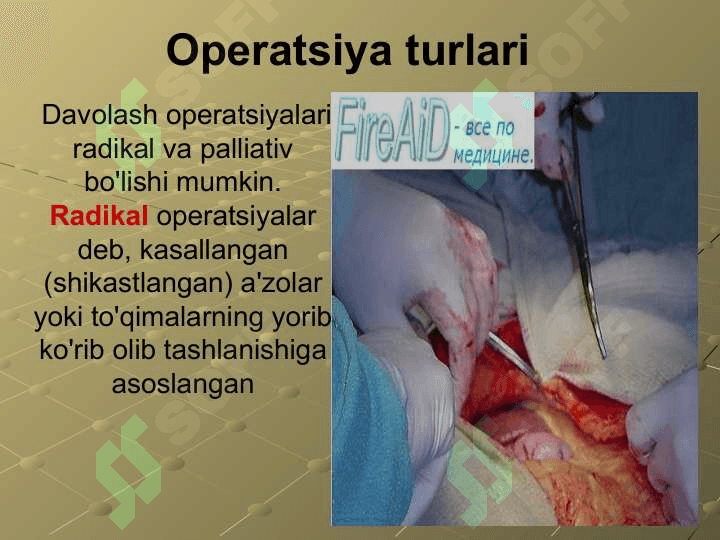 Xirurgik operatsiya va uning, turlari. Operatsiya oldi va operatsiyadan keyingi davrlar 4
