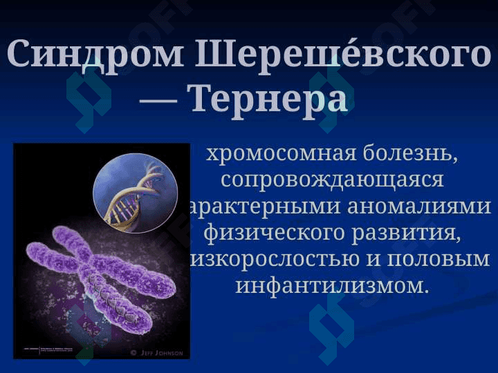 Синдром Шерешевского - Тернера 2