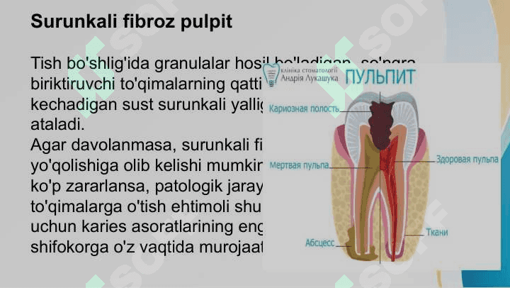 Surunkali fibroz pulpit 4