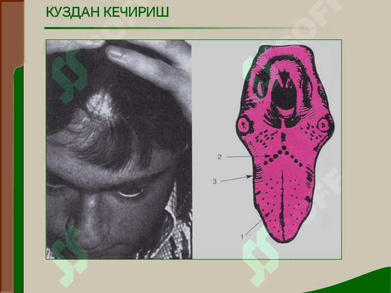Jigar oʼt yoʼllari tekshiriv usullari 4