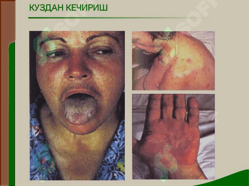 Jigar oʼt yoʼllari tekshiriv usullari 5