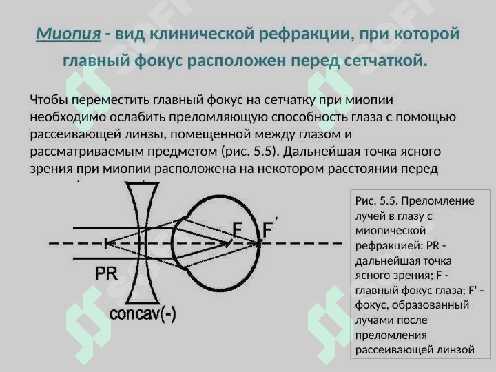 Физическая и клиническая рефракции. Аккомодация. Пресбиопия. Астигматизм. Назначение очков 8