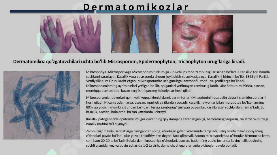 Zamburug'li kasalliklar. 3