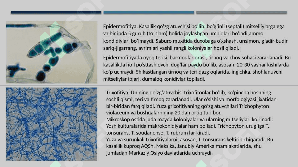 Zamburug'li kasalliklar. 4