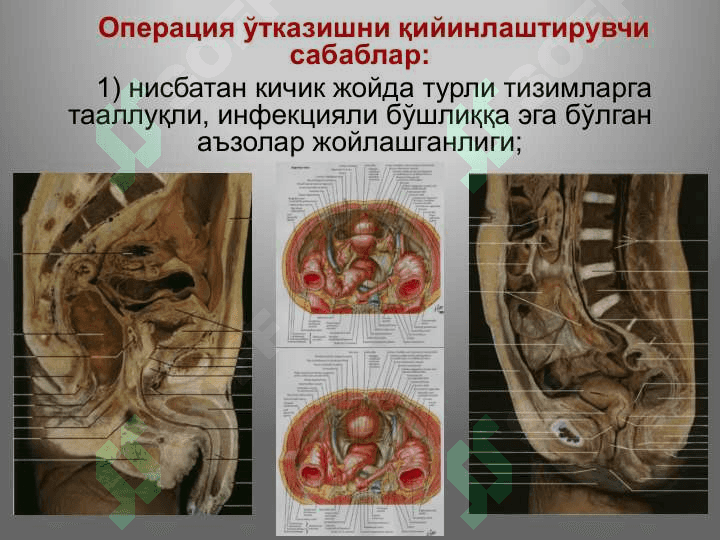 Тос соҳаси клиник анатомияси.             Тос бўшлиғи аъзоларидаги асосий операциялар. 5