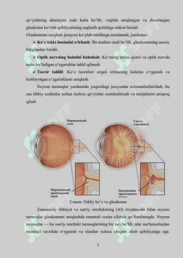 Ko‘z kasalliklarini neyron tarmoqlar orqali aniqlash algoritmlarining samaradorligi 5